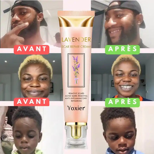 Yoxier Lavande Crème - Élimine Cicatrices, Vergetures & Chéloïdes,
