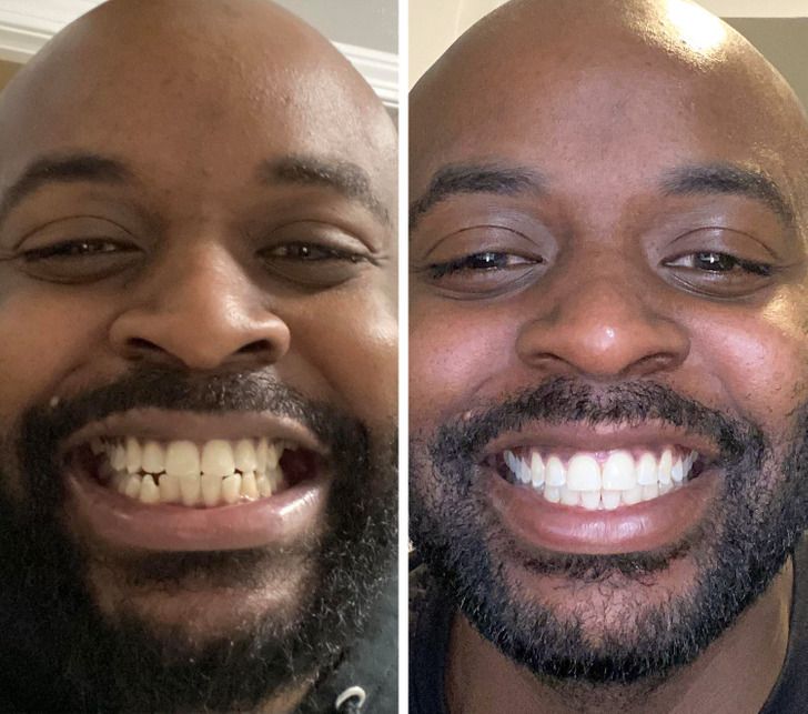 Dentifrice Blanchissant à la Niacinamide