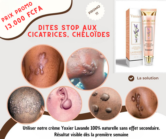 Yoxier Lavande Crème - Élimine Cicatrices, Vergetures & Chéloïdes,