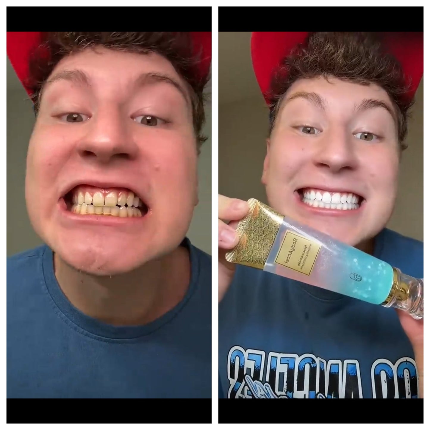 Dentifrice Blanchissant à la Niacinamide