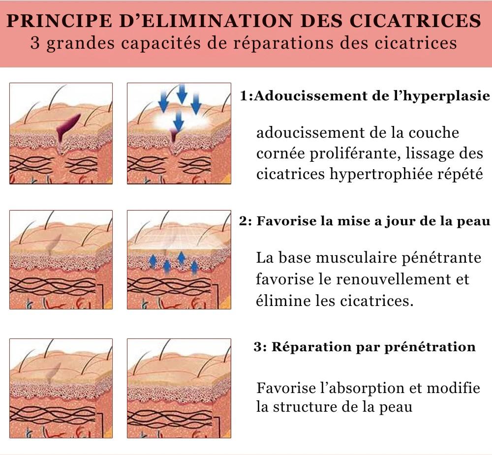 Yoxier Lavande Crème - Élimine Cicatrices, Vergetures & Chéloïdes,