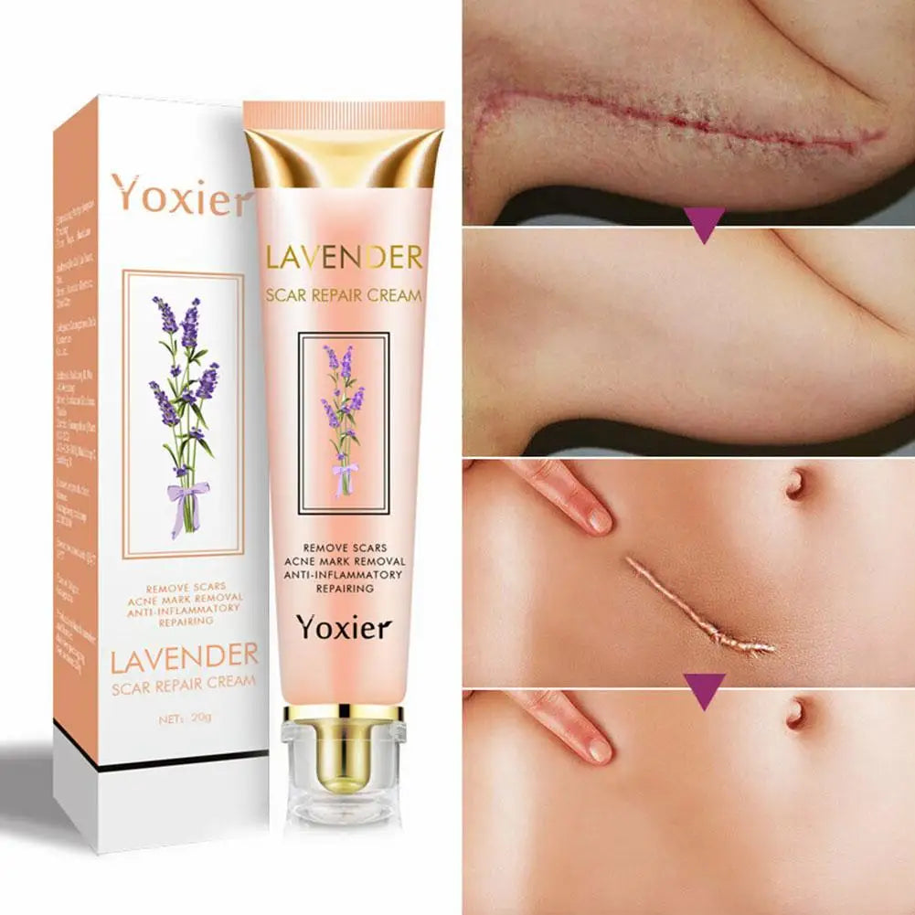 Yoxier Lavande Crème - Élimine Cicatrices, Vergetures & Chéloïdes,