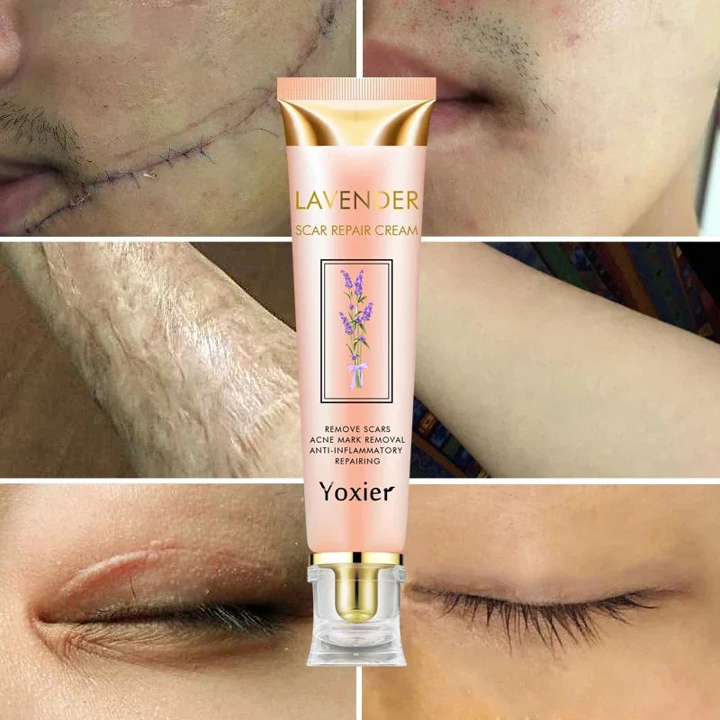 Yoxier Lavande Crème - Élimine Cicatrices, Vergetures & Chéloïdes,