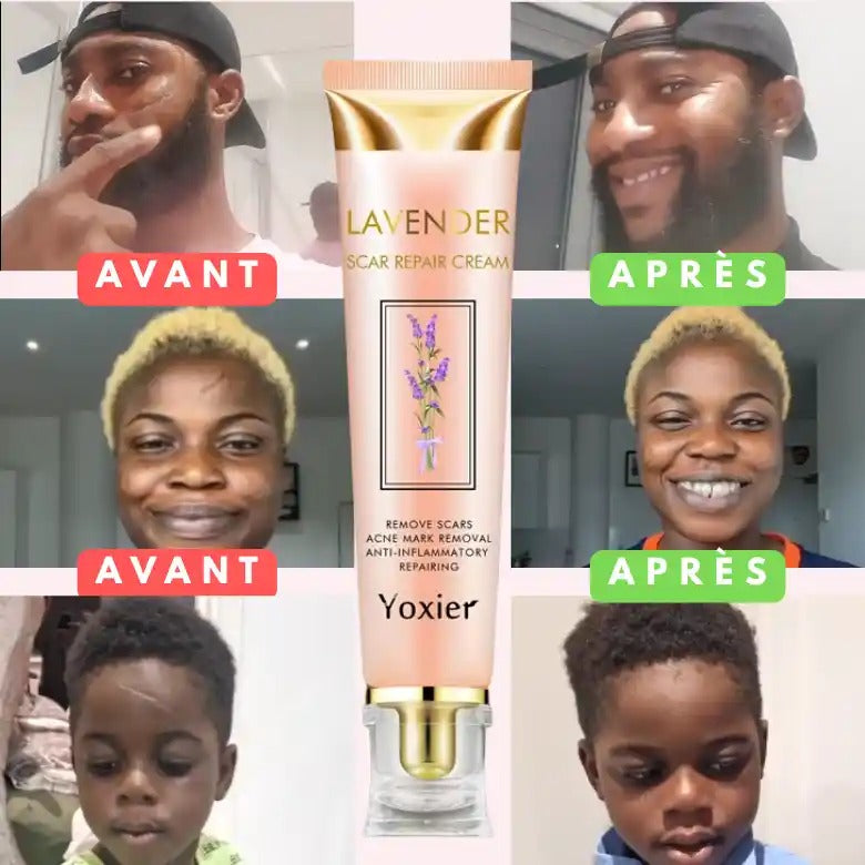 Yoxier Lavande Crème - Élimine Cicatrices, Vergetures & Chéloïdes,